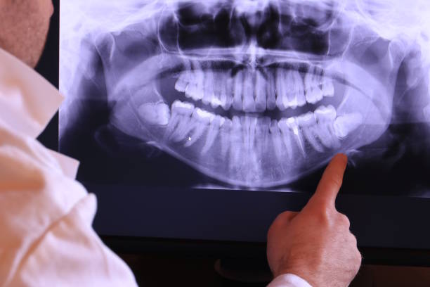 Best Emergency Tooth Extraction in Elsa, TX